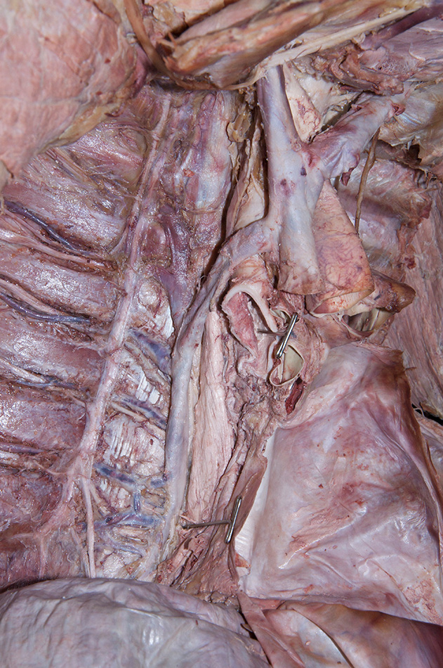 Azygos Vein