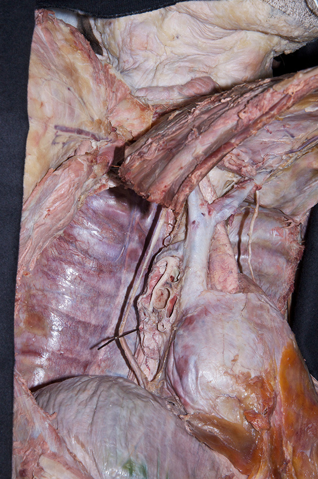 Arch of Azygos Vein