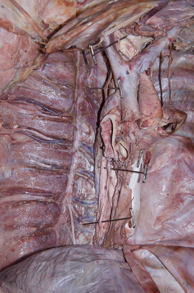 Right Vagus Nerve