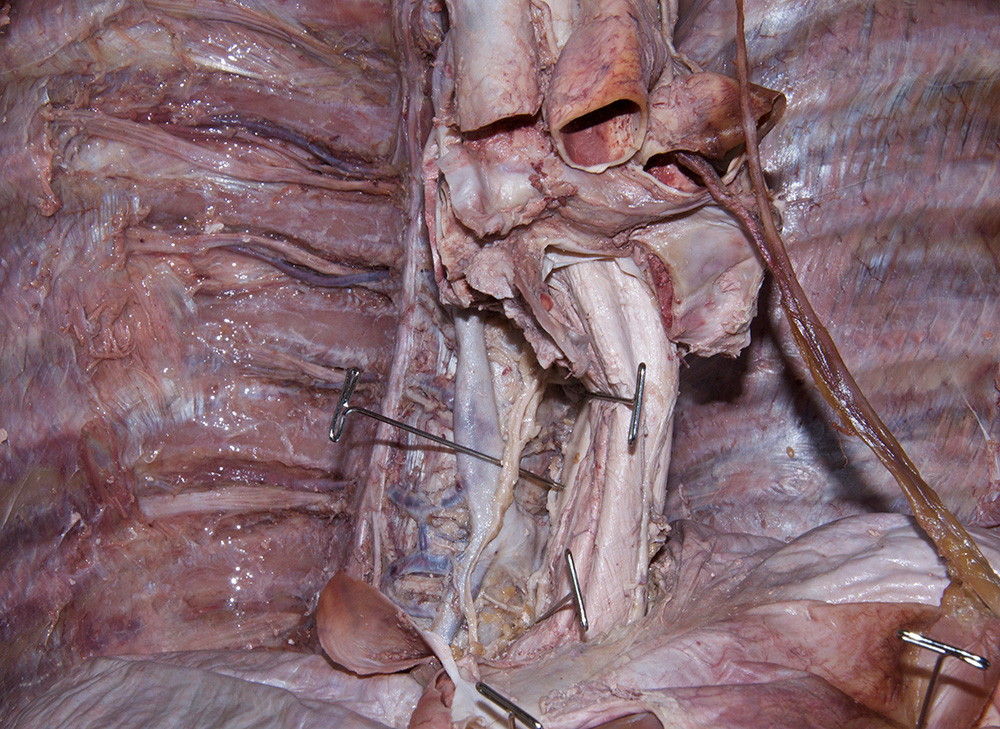 Thoracic Duct