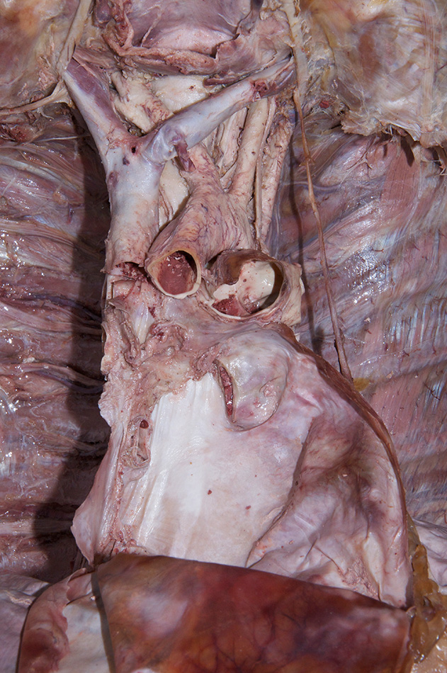 Aortic Arch