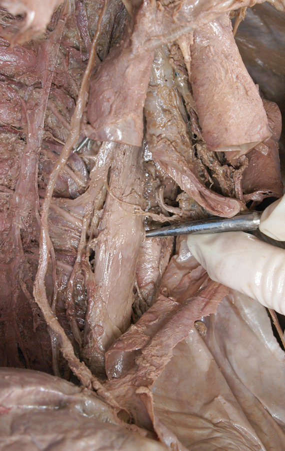 Esophagus