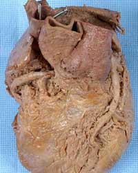 Heart - Anterior View