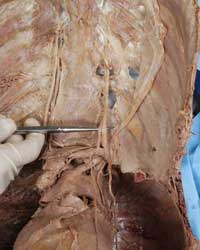 InternalThoracic Wall