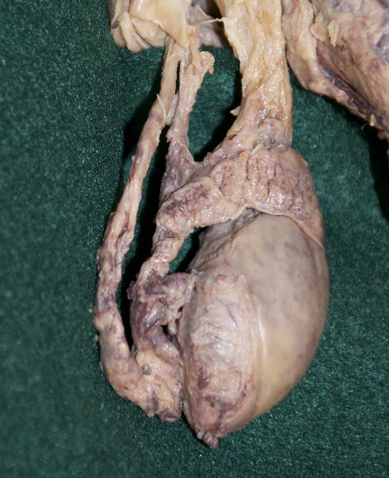 Male Perineum - 1