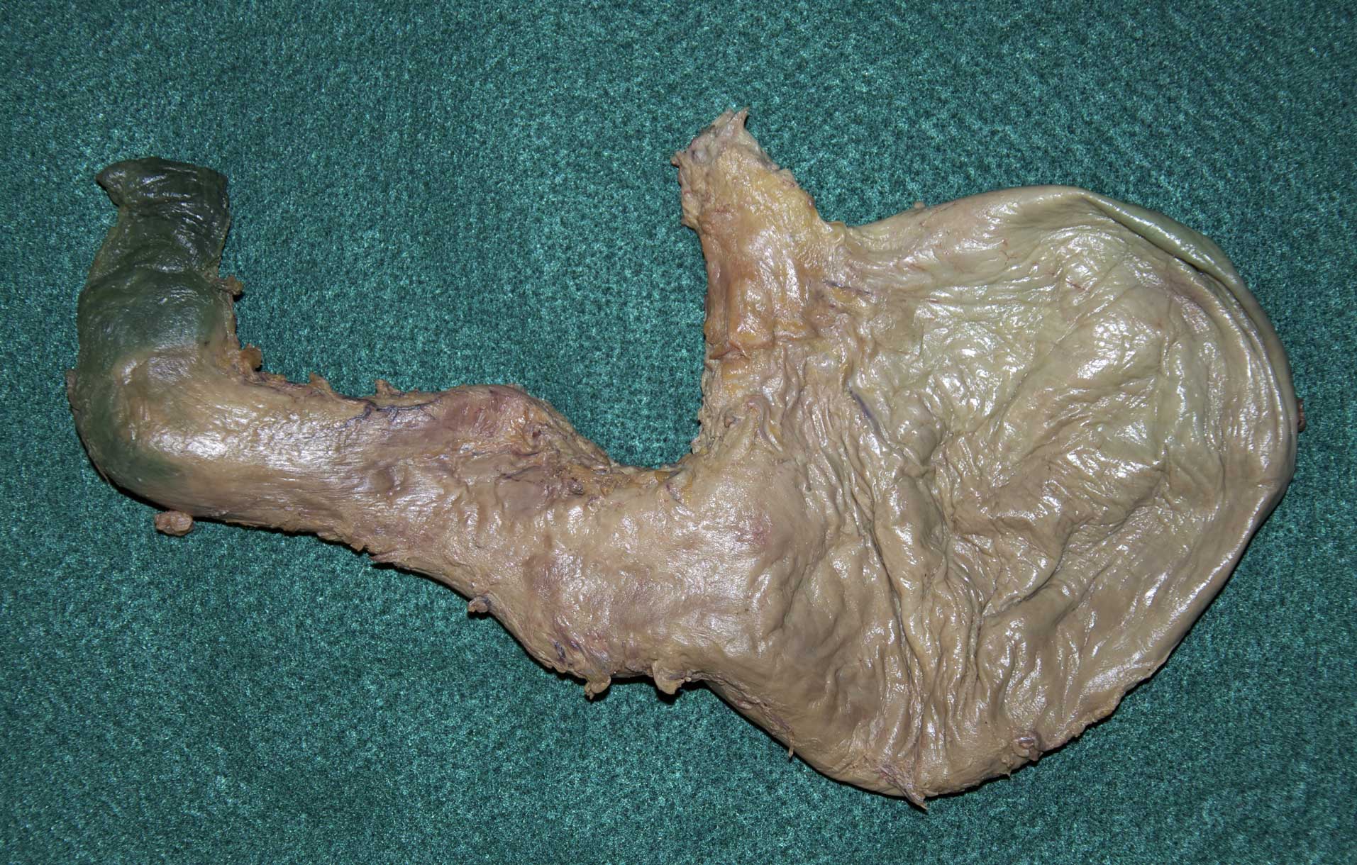 Abdominal Viscera - 2