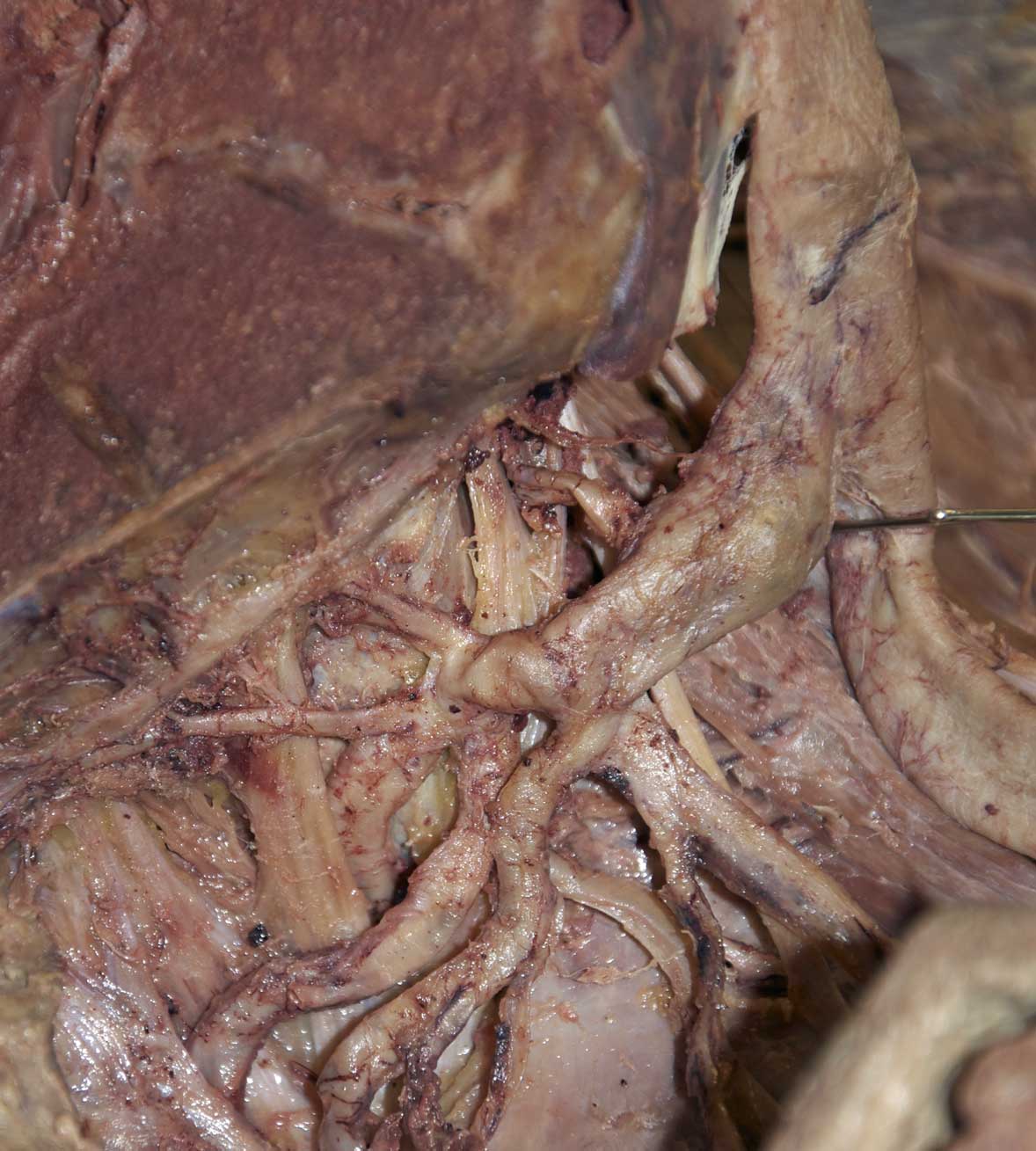 Male Pelvis - 3