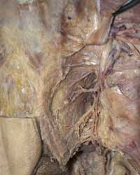 Ischiorectal Fossa