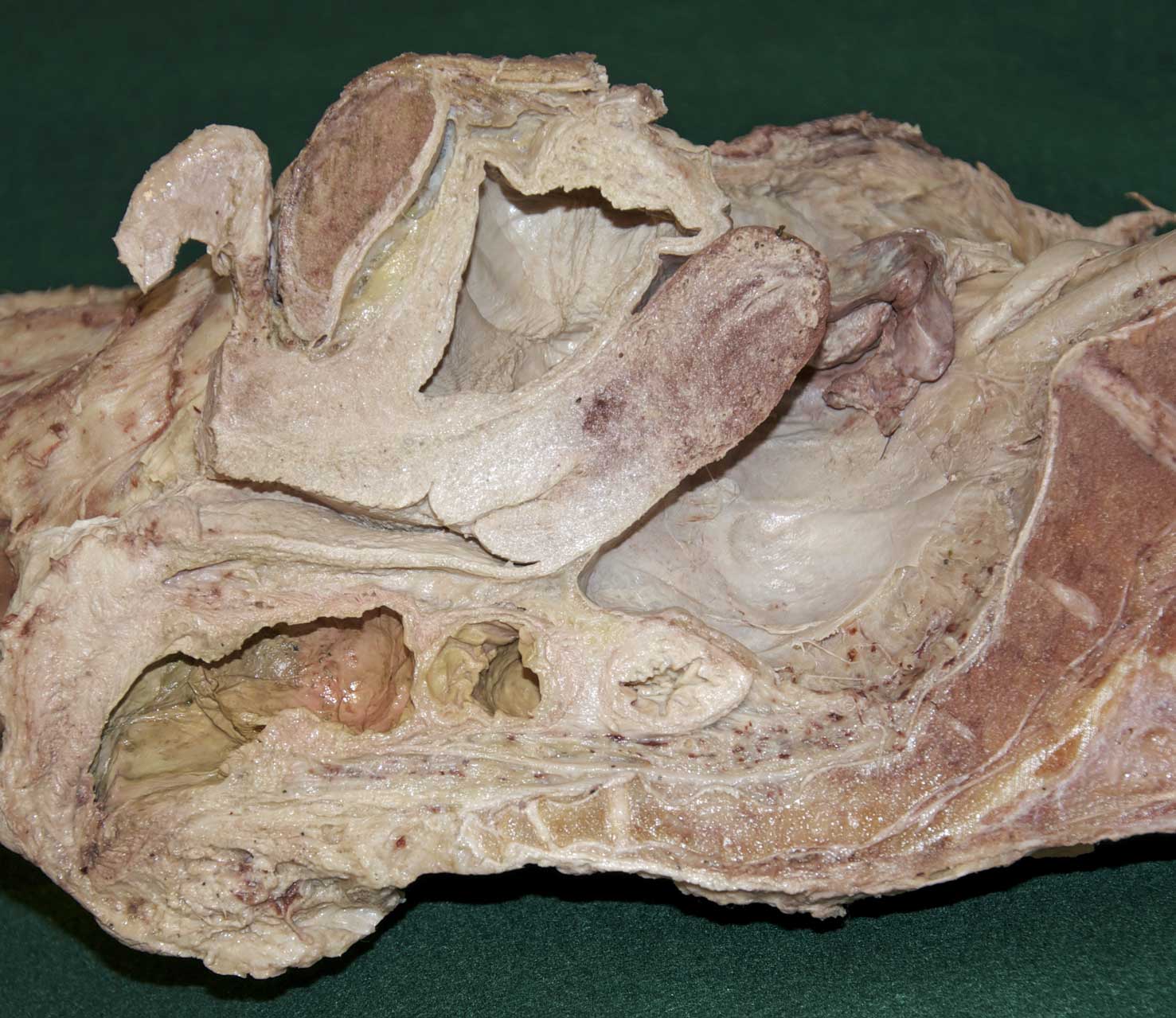 Female Pelvis - 2