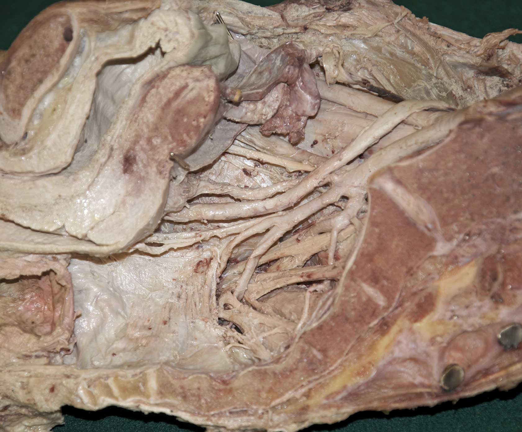 Female Pelvis - 5