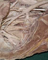 Posterior Pelvic Arteries
