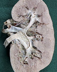 Retroperitoneal Viscera