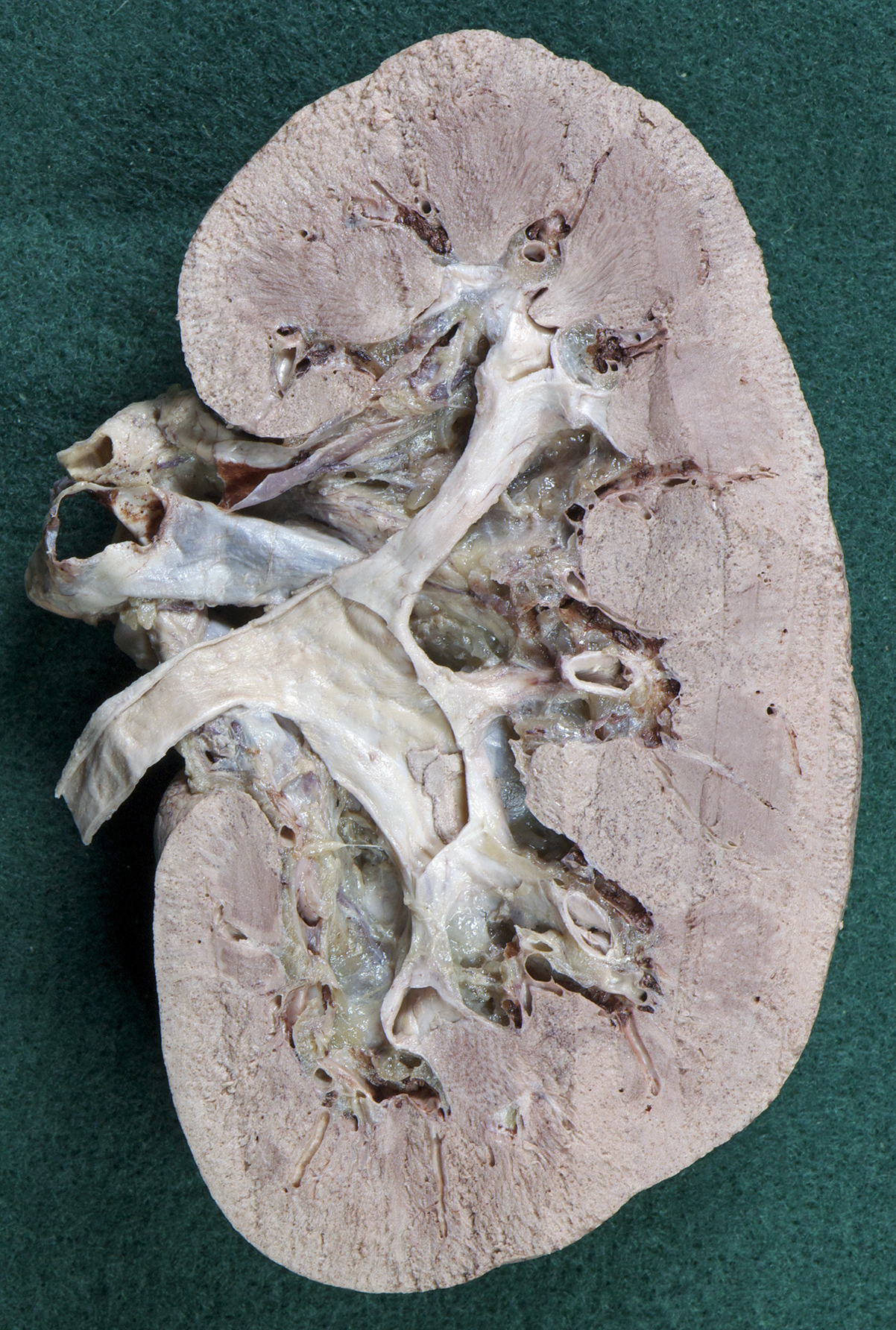 Retroperitoneal Viscera - 3