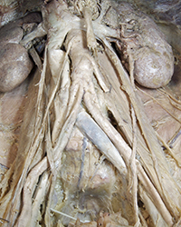 Retroperitoneal Viscera