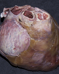 Left Ventricle