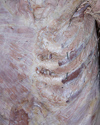Posterior Thoracic Wall