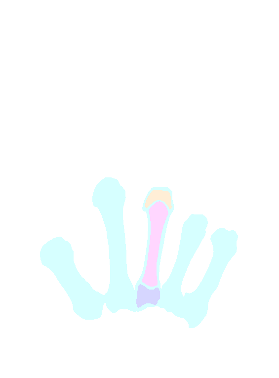Metacarpals