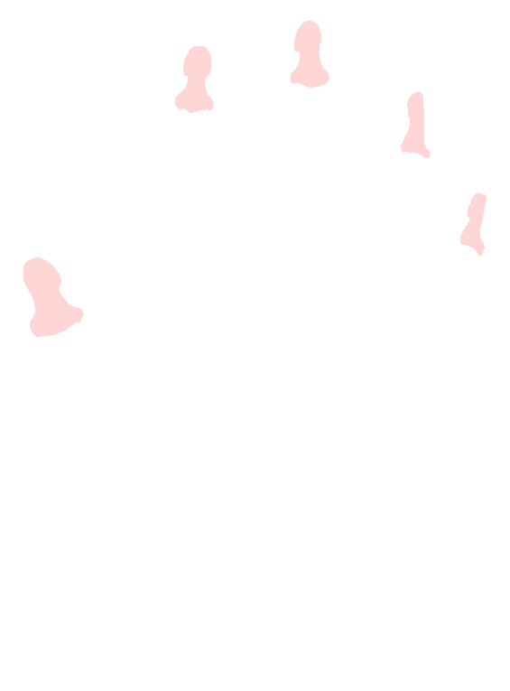 Distal