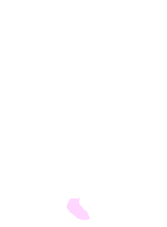 Scaphoid