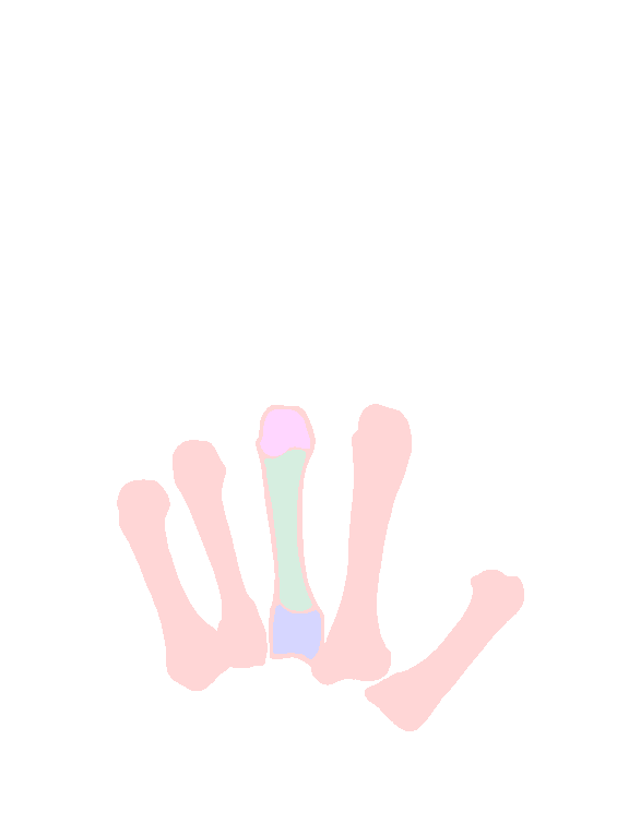 Metacarpals