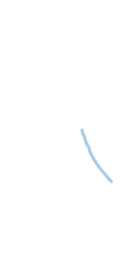 Medial Supracondylar Ridge