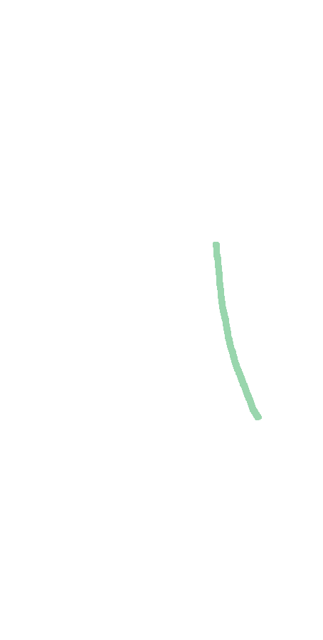 Medial Supracondylar Ridge