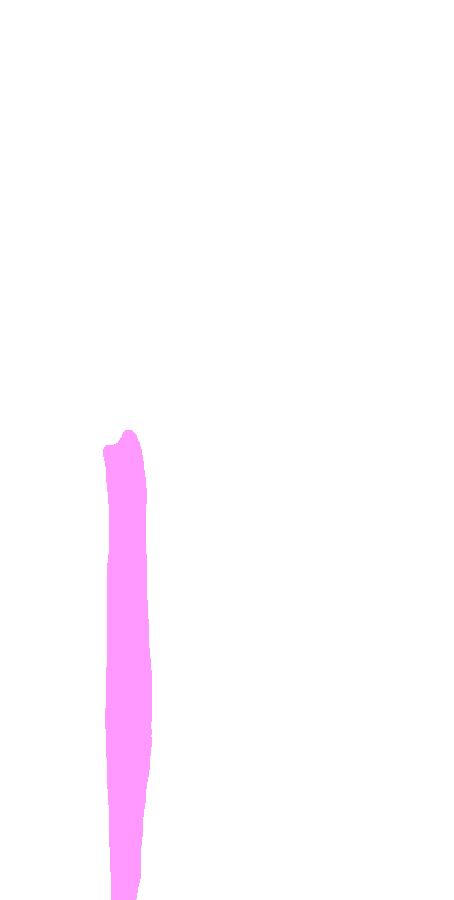 Lateral Lip of Intertubercular Sulcus