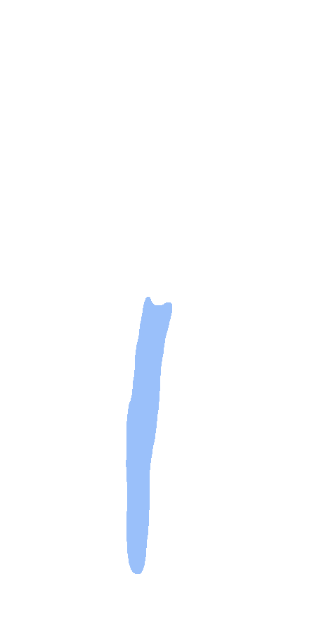 Medial Lip of Intertubercular Sulcus