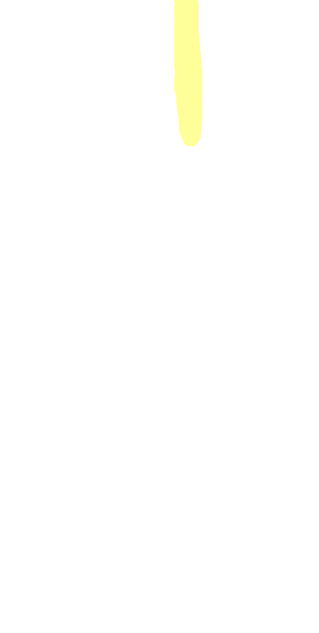 Lateral Lip of Intertubercular Sulcus