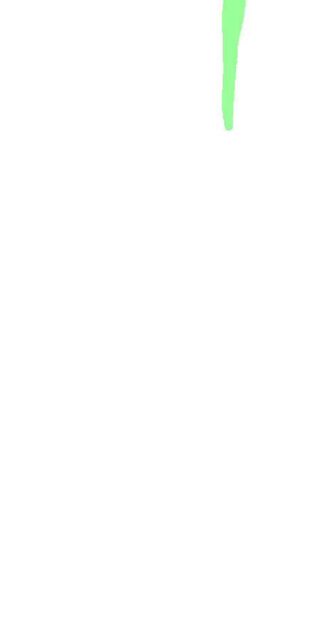 Medial Lip of Intertubercular Sulcus