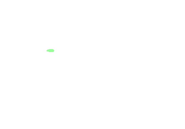 Conoid Ligament
