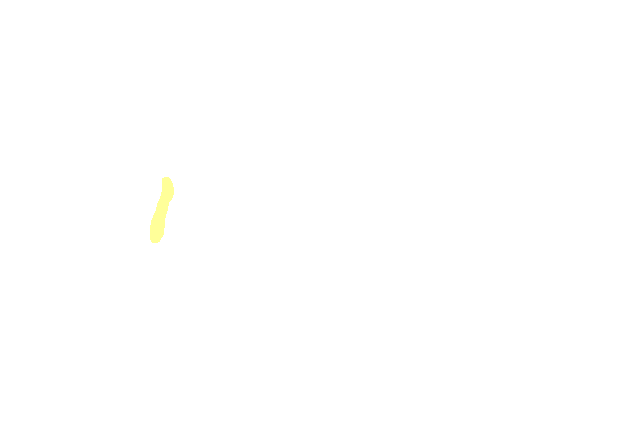 Trapezoid Ligament