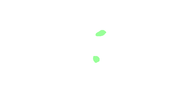 Conoid Ligament