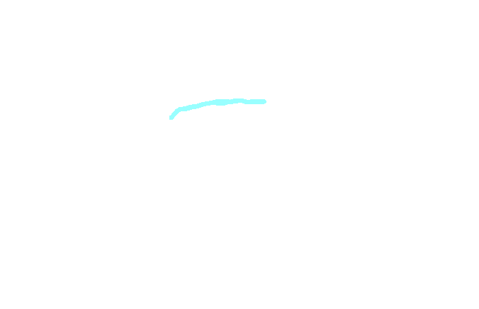 Trapezoid Ligament