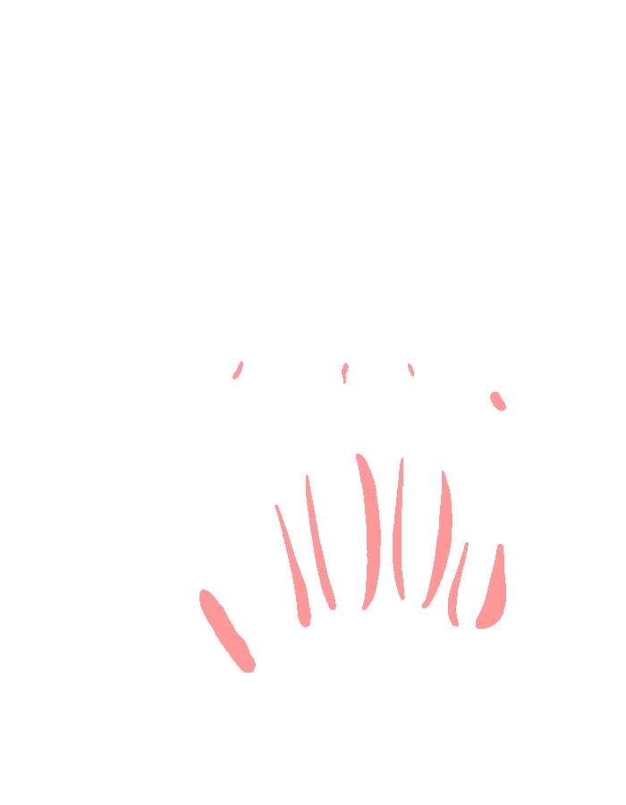 Dorsal Interossei