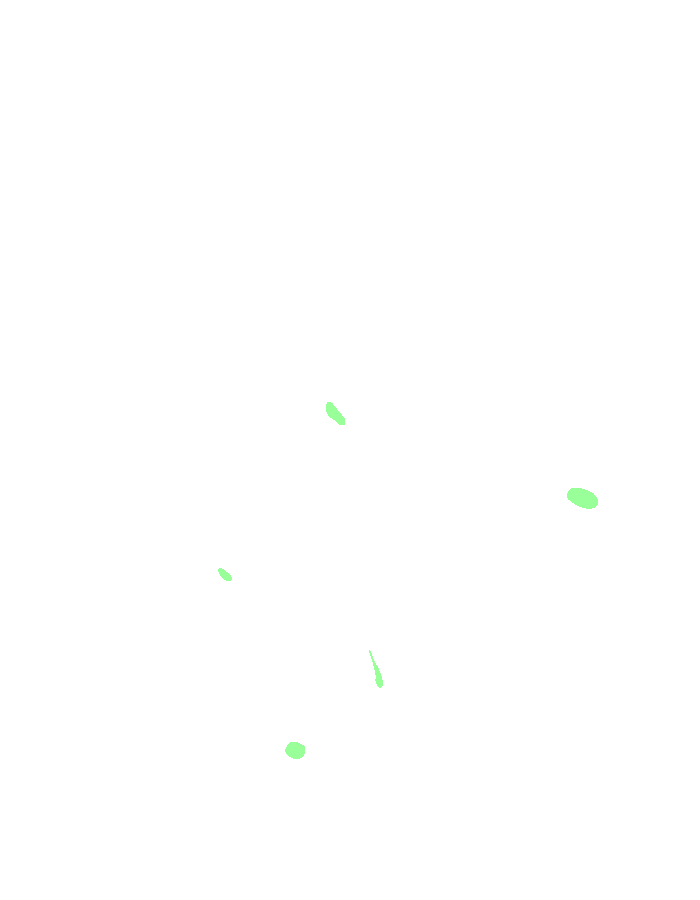 Palmar Interossei