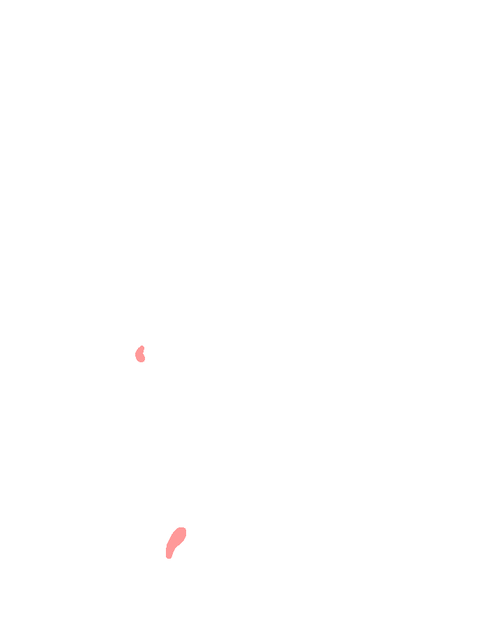 Abductor Digiti Minimi