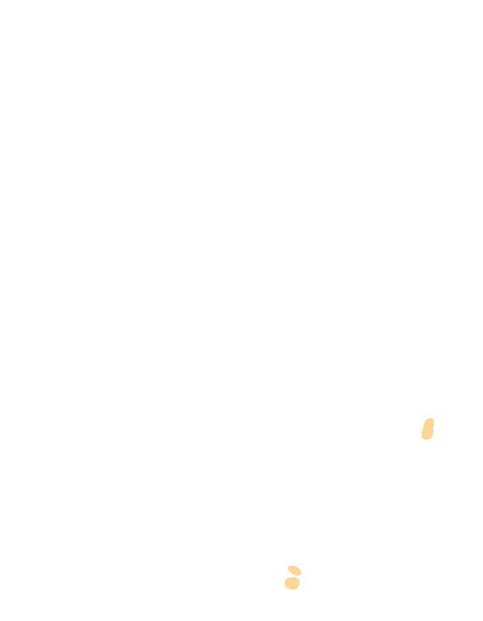 Abductor Pollicis Brevis