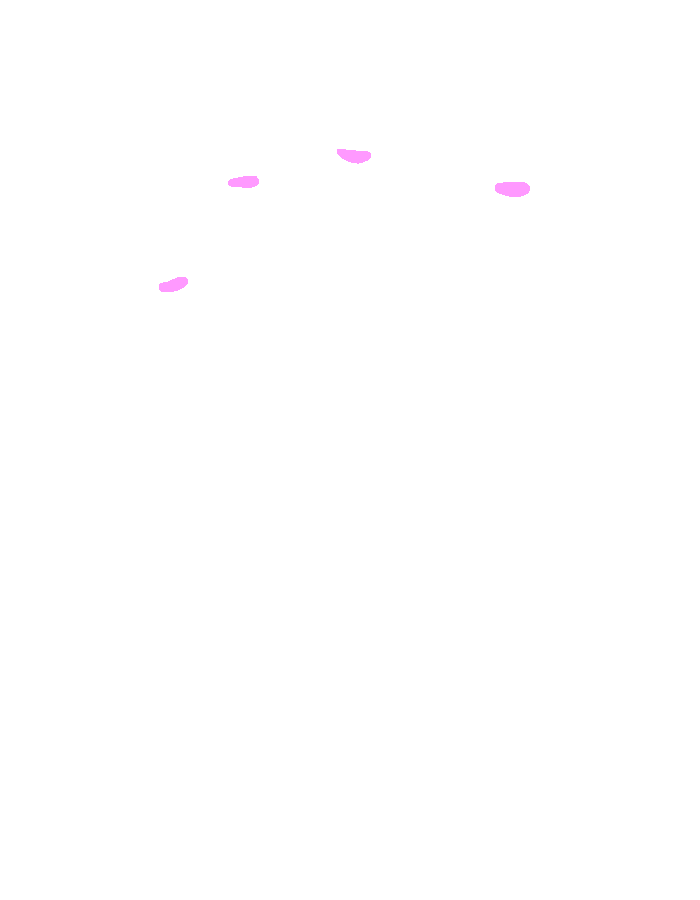 Flexor Digitorum Profundus