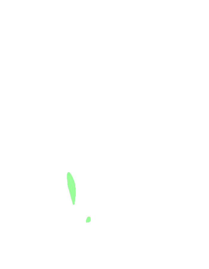 Opponens Digiti Minimi