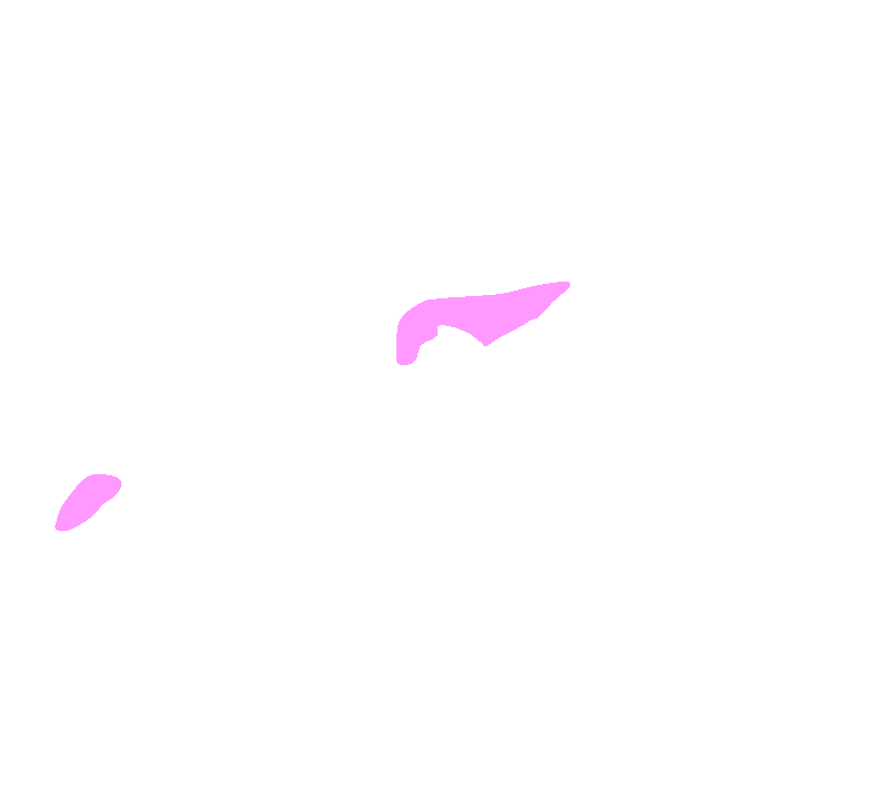 Supraspinatus