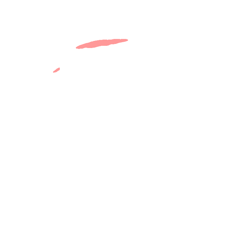 Trapezius