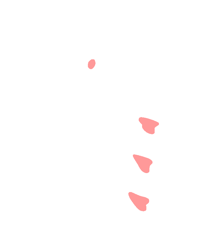 Pectoralis Minor
