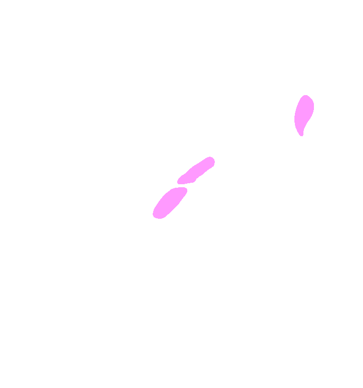 Teres Minor