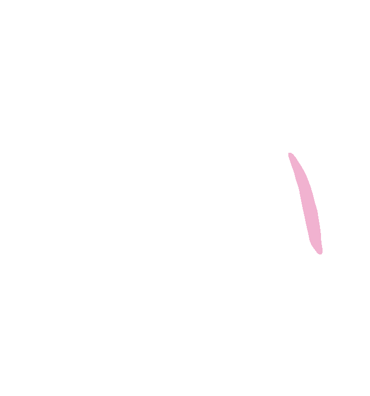 Triceps - Lateral Head