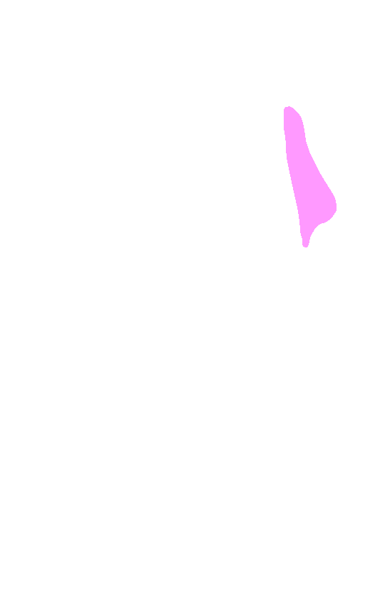 Lateral Angle