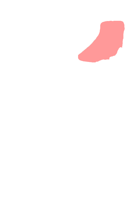 Acromion