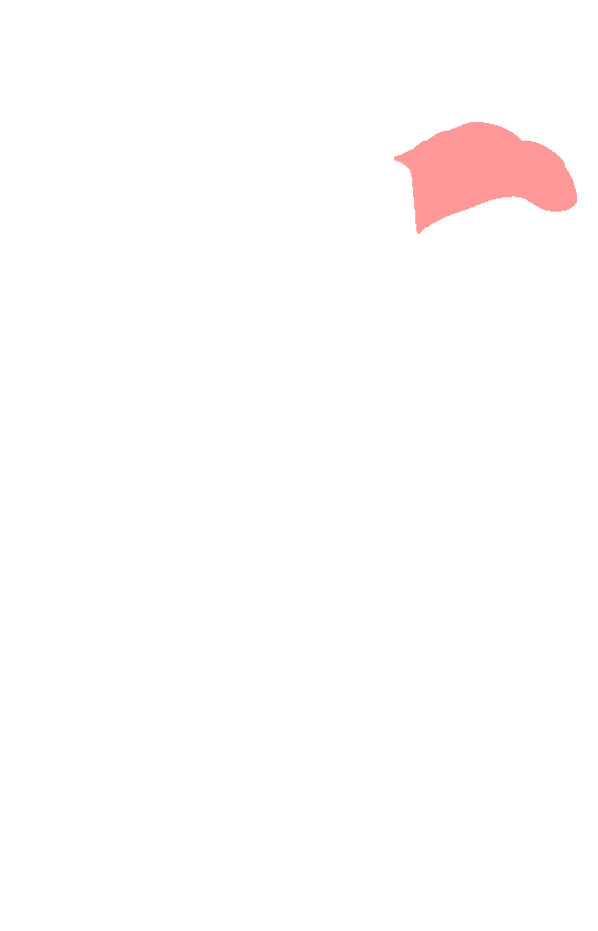 Coracoid Process