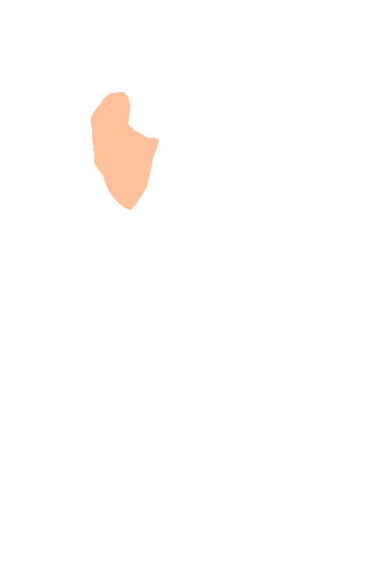 Coracoid Process