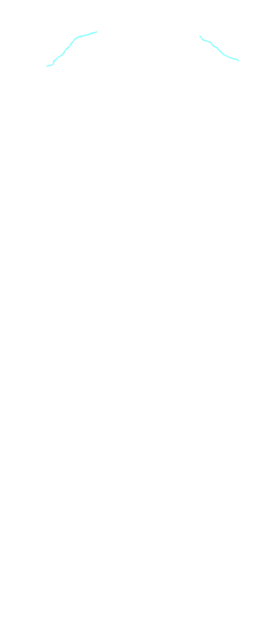 Clavicular Notch